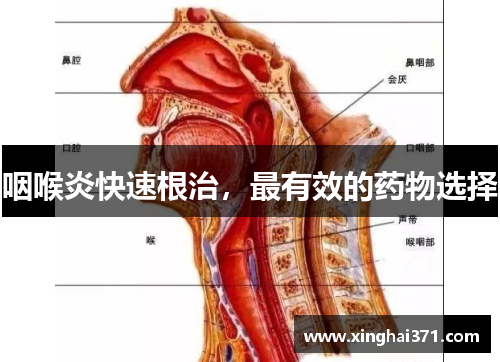 咽喉炎快速根治，最有效的药物选择